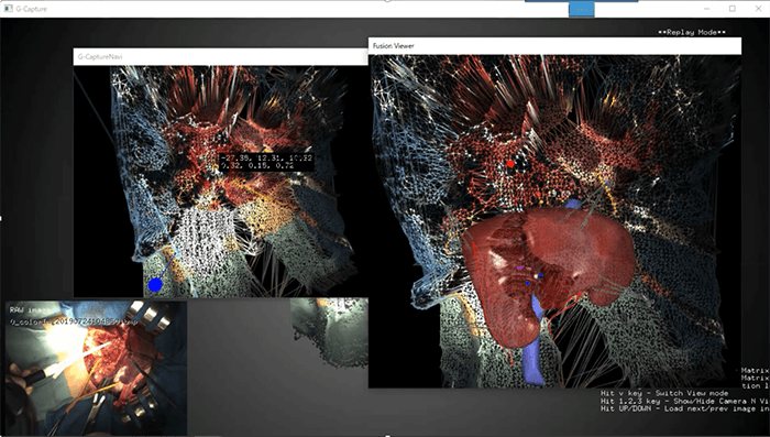 筑波大学「次世代型の3DCGバーチャル手術シミュレーションシステム」の画像